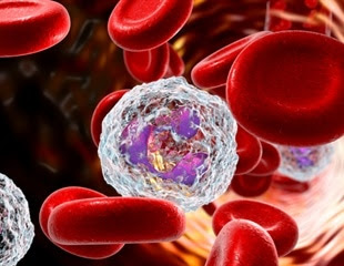 Neutrophil nanosponges provide hope for rheumatoid arthritis