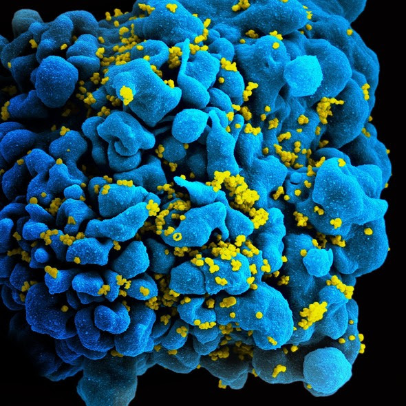 HIV-infected H9 T cell