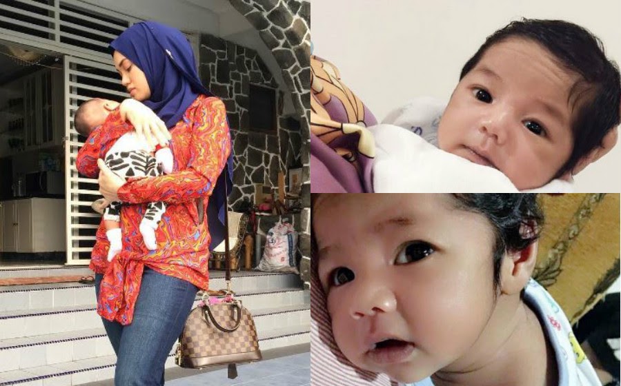 bayi: Demam Campak Halus Bayi