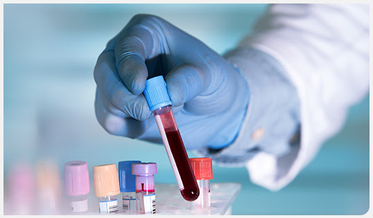 Lab technician with a blood sample