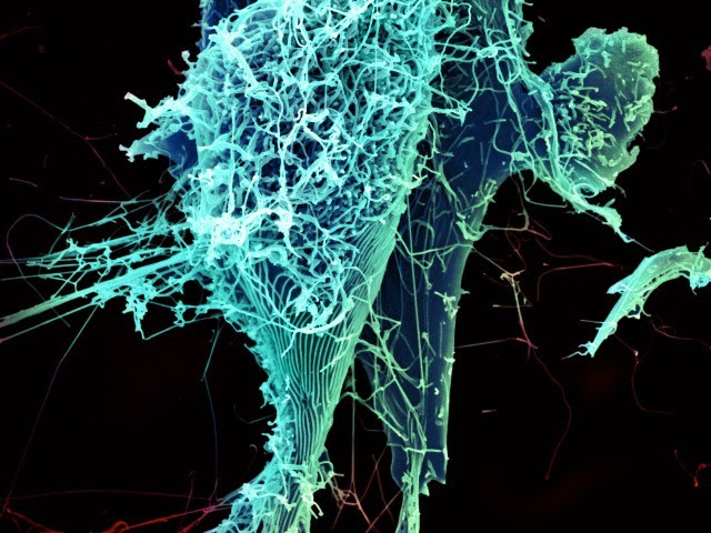 Ebola Virus Particles 