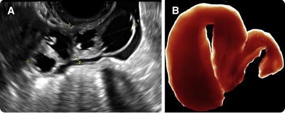 A pelvic ultrasound is a safe procedure that can be slightly uncomfortable. Ob Gyn Specialists Suggest An Ultrasound First Approach To Imaging Female Pelvis