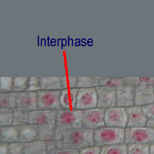 Fluid collects in the plant cell vacuole and pushes out against the cell wall. Microscopy