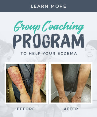 I was almost impressive at how comedogenic it is. 5 Methods For Healing Weeping Eczema Naturally