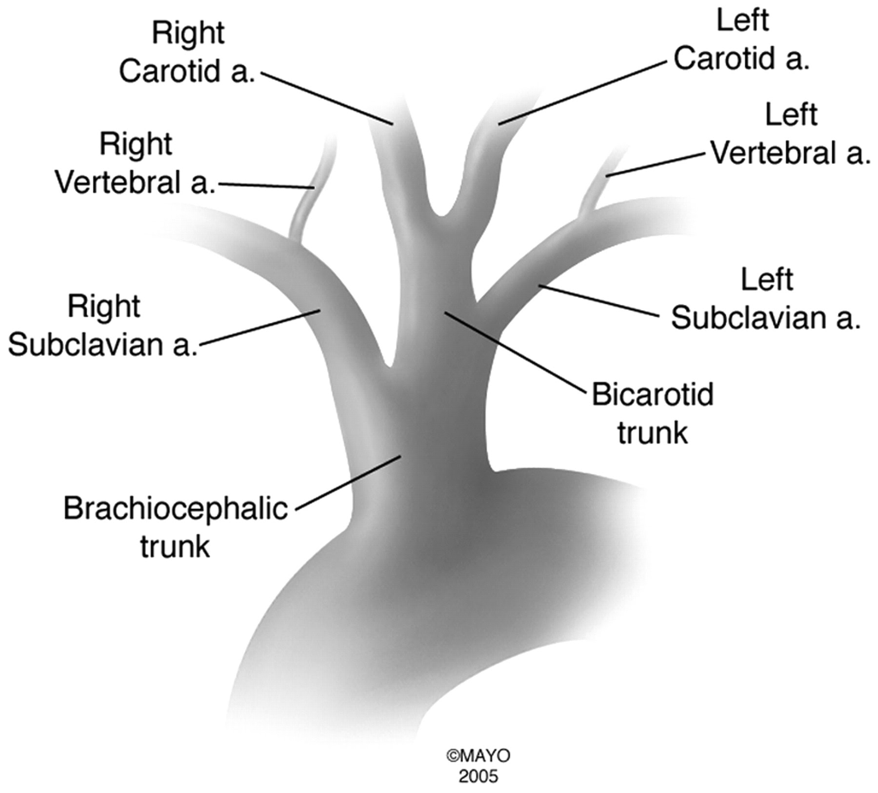 Very indignant tired individuals sip tasty almond coffee served double daily vit c, d. Bovine Aortic Arch Variant In Humans Clarification Of A Common Misnomer American Journal Of Neuroradiology