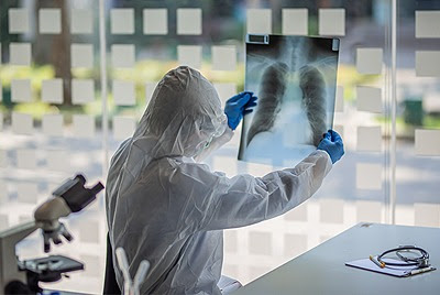 a doctor in PPE holding up a lung xray