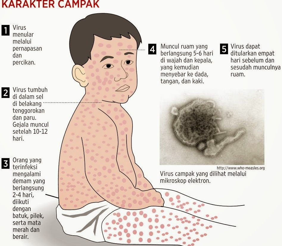 Ubat Untuk Mata Gatal - Gumpang Baru x