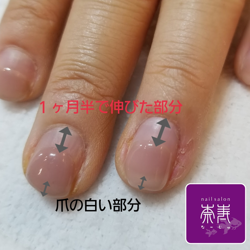 爪 ピンク の 部分 増やす