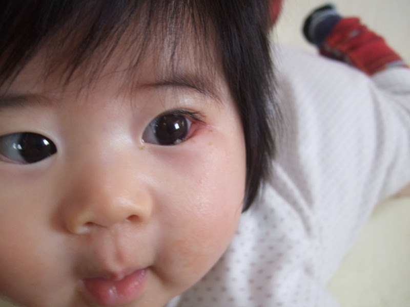 新鮮な子供 目尻 赤い かわいい子供たちの画像