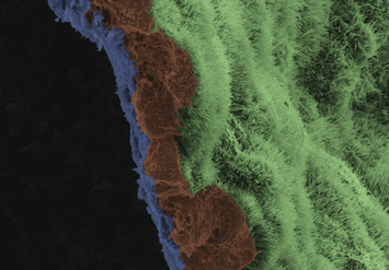 Polarized RPE monolayer on biodegradable scaffold