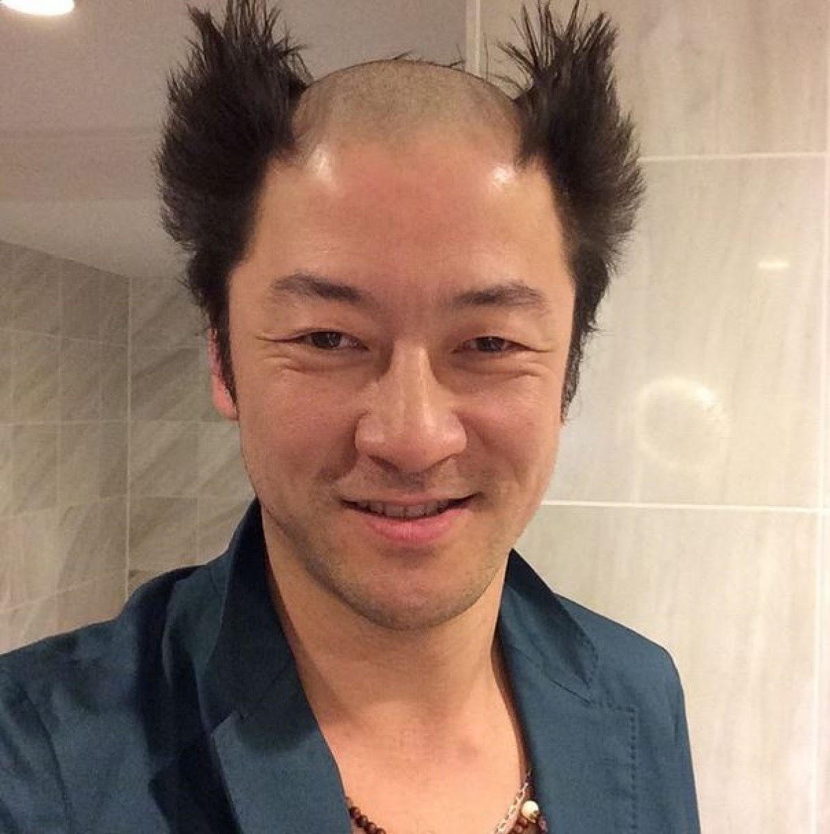 若 はげ かっこいい