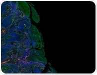 Optimization Tips for Immunohistochemistry and Immunofluorescence