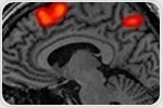 Nature of social cognitive deficits in people with progressive multiple sclerosis