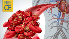 Semi-solid mass of blood cells and blood components trapped in a fibrin network, also known as a blood clot.