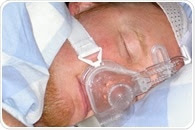 Sleep apnea can favor lung cancer growth in young individuals