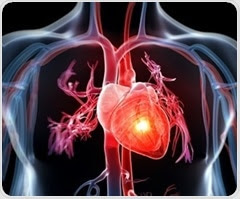 People with family history of heart attack may be more at risk