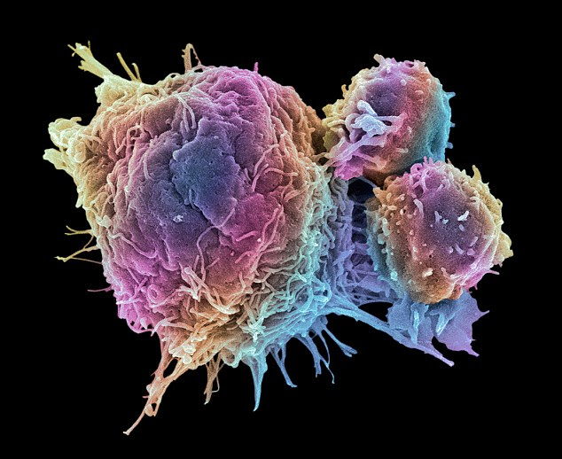 Cancer cells died after the treatment forced 'cell suicide'