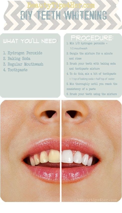 Diy teeth whitening that really works