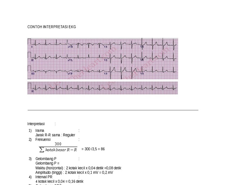 Contoh Soal Interpretasi Ekg Dan Jawabannya Dunia Sekolah Id