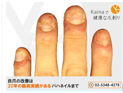 ネイル チップ 接着 ネイルアート最高の画像