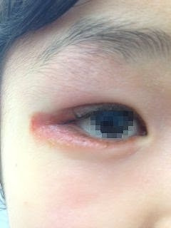 エレガント子供 目の周り 赤い かわいい子供たちの画像