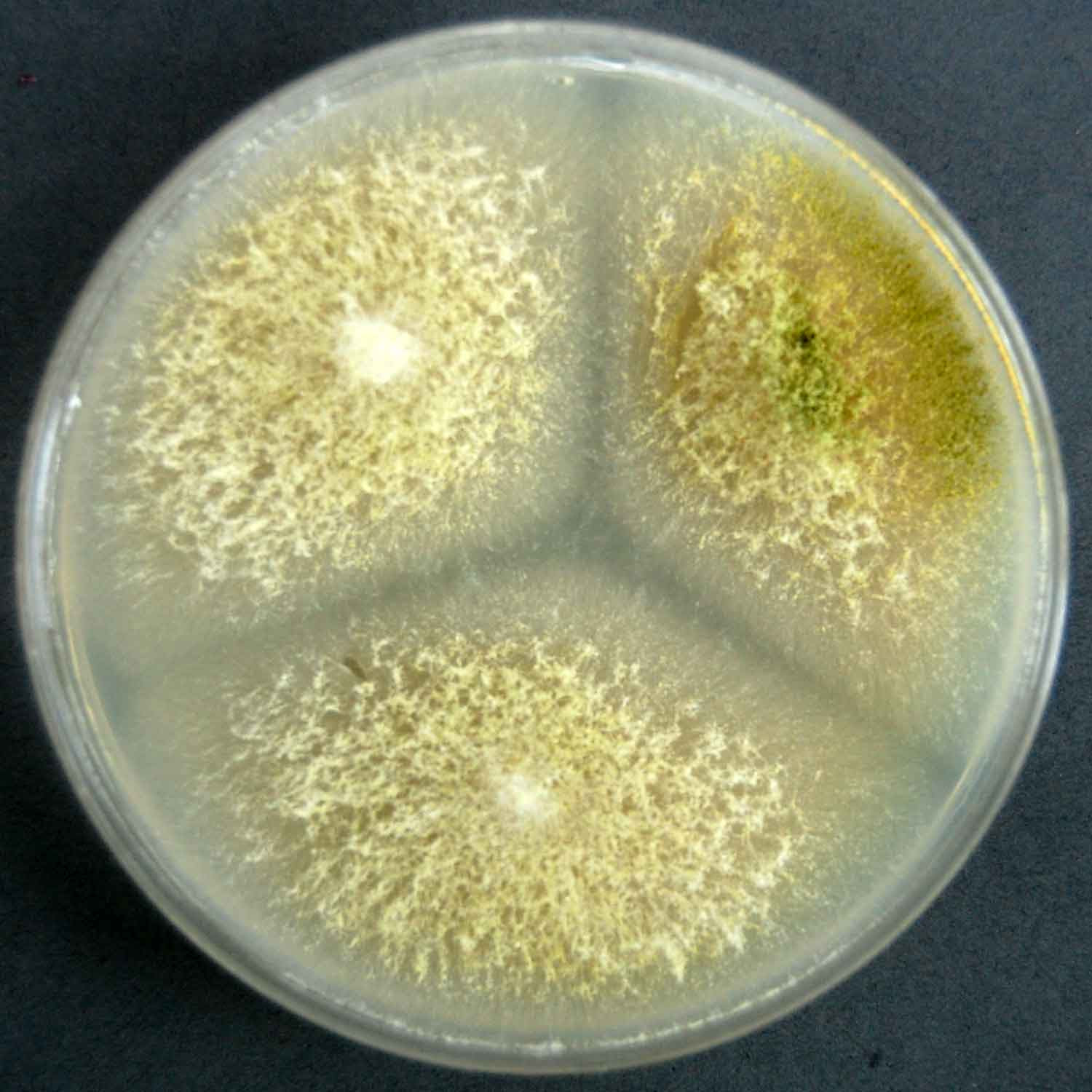 Some of these species (such as a. Aspergillus Flavus