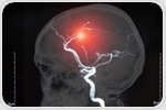 What is Cerebrovascular Disease?