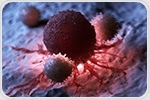 Patients with biliary tract cancer have altered genetic architecture in immune system