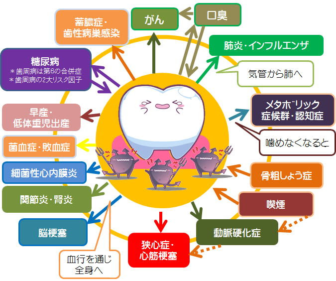 すべての動物の画像 50 素晴らしい歯周病 イラスト 無料