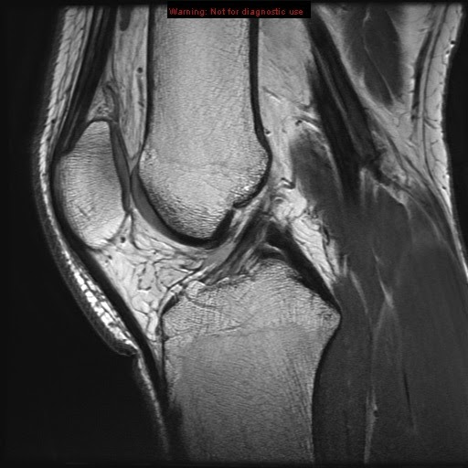 Carefully labeled mris for all body parts, as well as schematic diagrams and concise statements, clarify correlations between bones and tissues. Stanford Msk Mri Atlas 2020