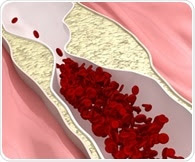 Researchers show novel relationship between gut microbiome and atherosclerosis