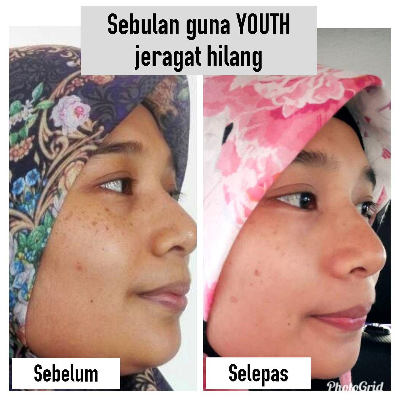 Ubat Jeragat Yang Berkesan Di Farmasi - Kronis b