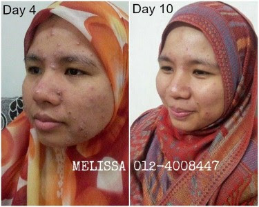 Ubat Demam Panas Untuk Orang Dewasa - Harga HP 4
