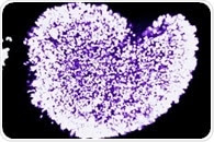 "Jumping genes" within eggs determine their survival