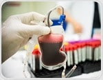 Blood transfusions should be gender matched between donor and recipient