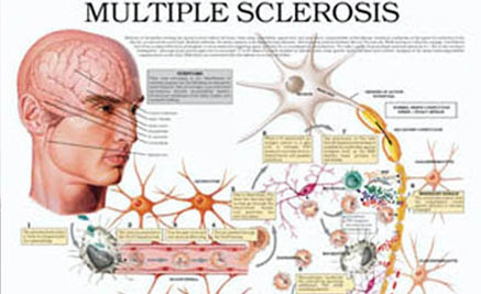 May 26, 2021 · a maía. Dia Mundial De La Esclerosis Multiple