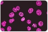 Multiplex Approach to Fluorescent Western Blotting