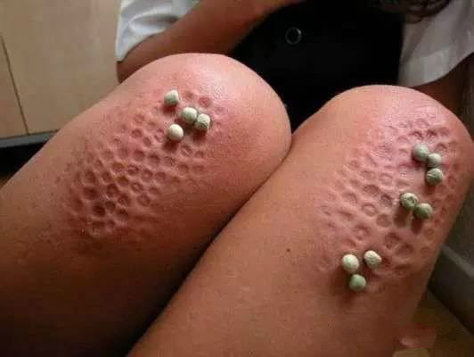 トップレート 集合体画像 最高の画像画像