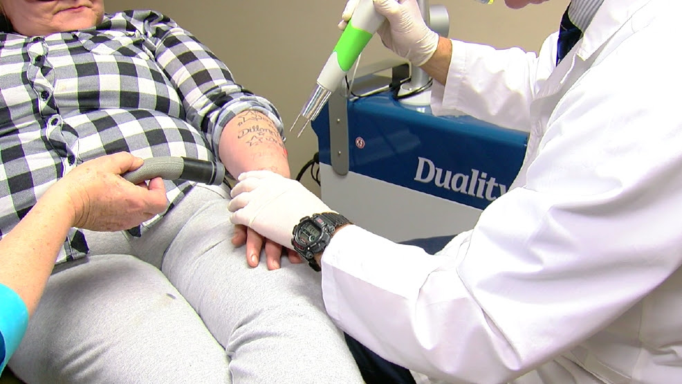 Tattoo Removal Cincinnati - Tatto Pictures