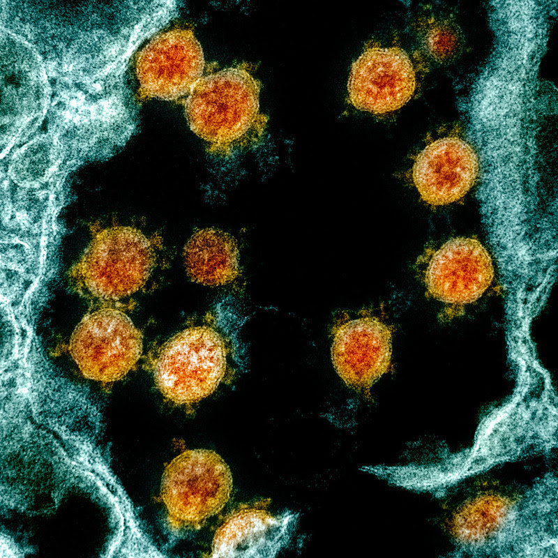 Coronavirus Image E-234-2016