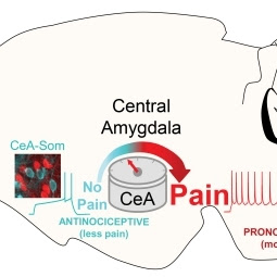 pain amygdala yarimar carrasquillo