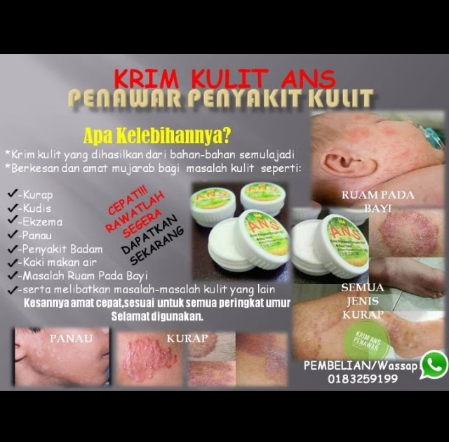 Sabun Panau Di Farmasi  Ubat Parut Jerawat Yang Berkesan Di Farmasi