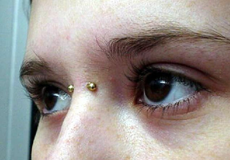 Other symptoms you may experience. Bridge Or Earl Piercing