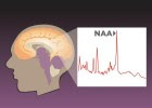 A new study found that higher concentrations of NAA (N-acetyl aspartate) in the medial parietal and posterior cingulate cortices of the brain were associated with better performance on verbal and spatial tests. NAA is a byproduct of glucose metabolism and an indicator of brain health. (credit: Graphic by Julie McMahon and Erick Paul)