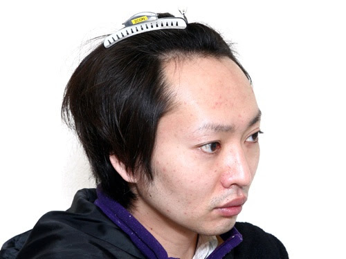 ベスト50 おでこ 広い 男 髪型 すべての髪型のインスピレーション
