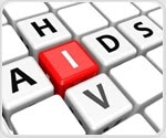 HIV directly impacts the brain in early stages of infection