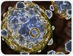 FFF-MALS-DLS for analysis of exosomes