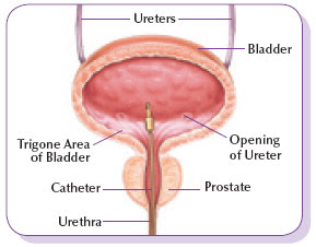 Bcg Treatment Urology Associates Of Central California