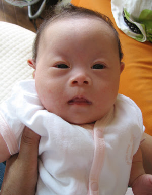 有名な 新生児 鼻 大きい 画像ブログ