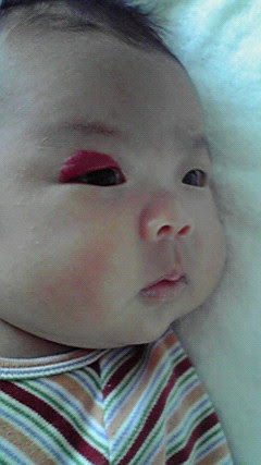 綺麗な子供 目の周り 赤い 腫れ かわいい子供たちの画像